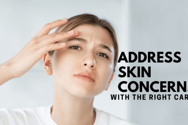 How to treat common skin concerns How to treat common skin concerns
