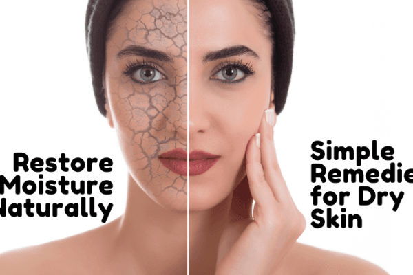 Natural remedies for dry and flaky skin Natural remedies for dry and flaky skin
